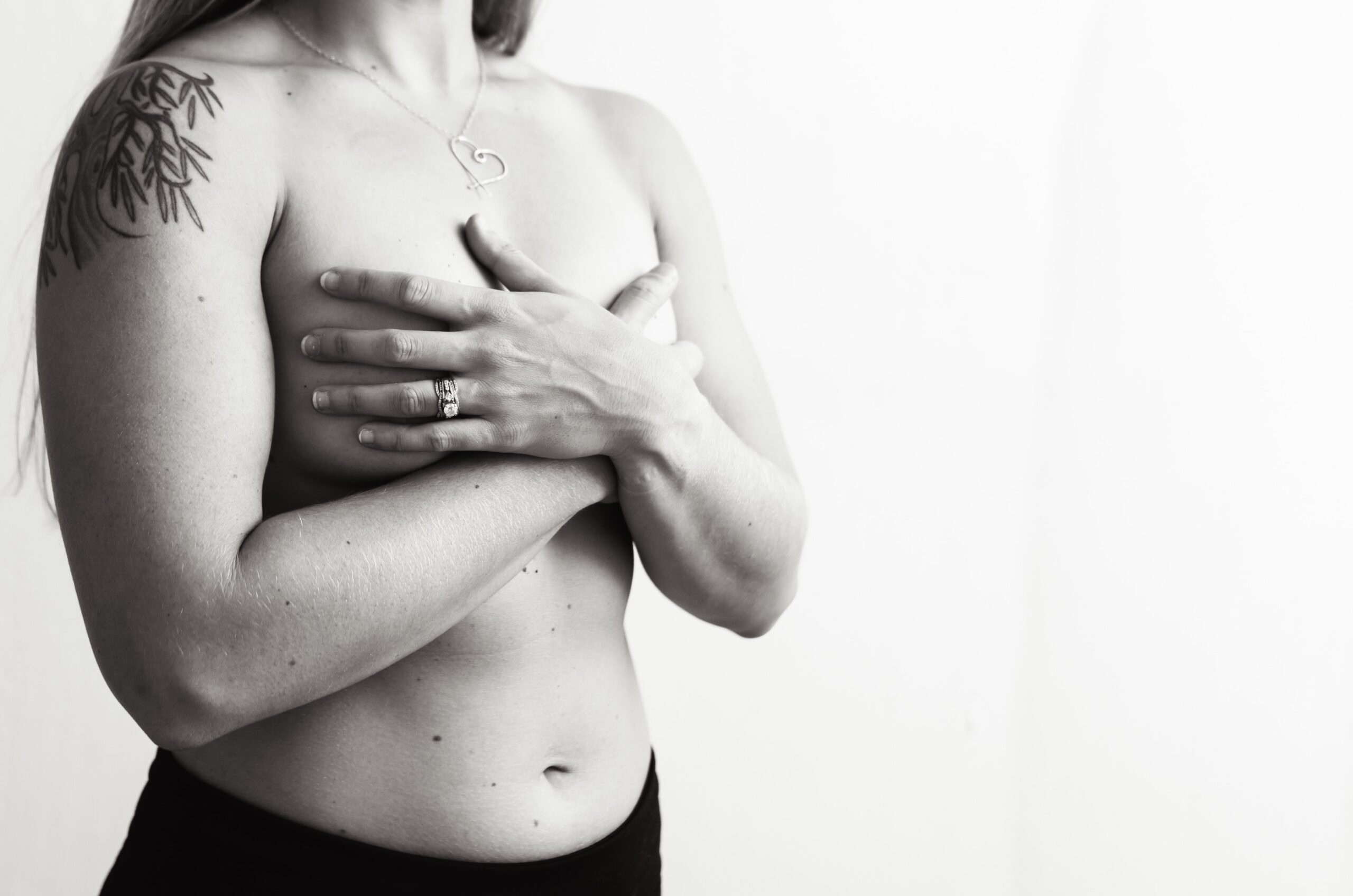 Breast Engorgement After Pregnancy Loss